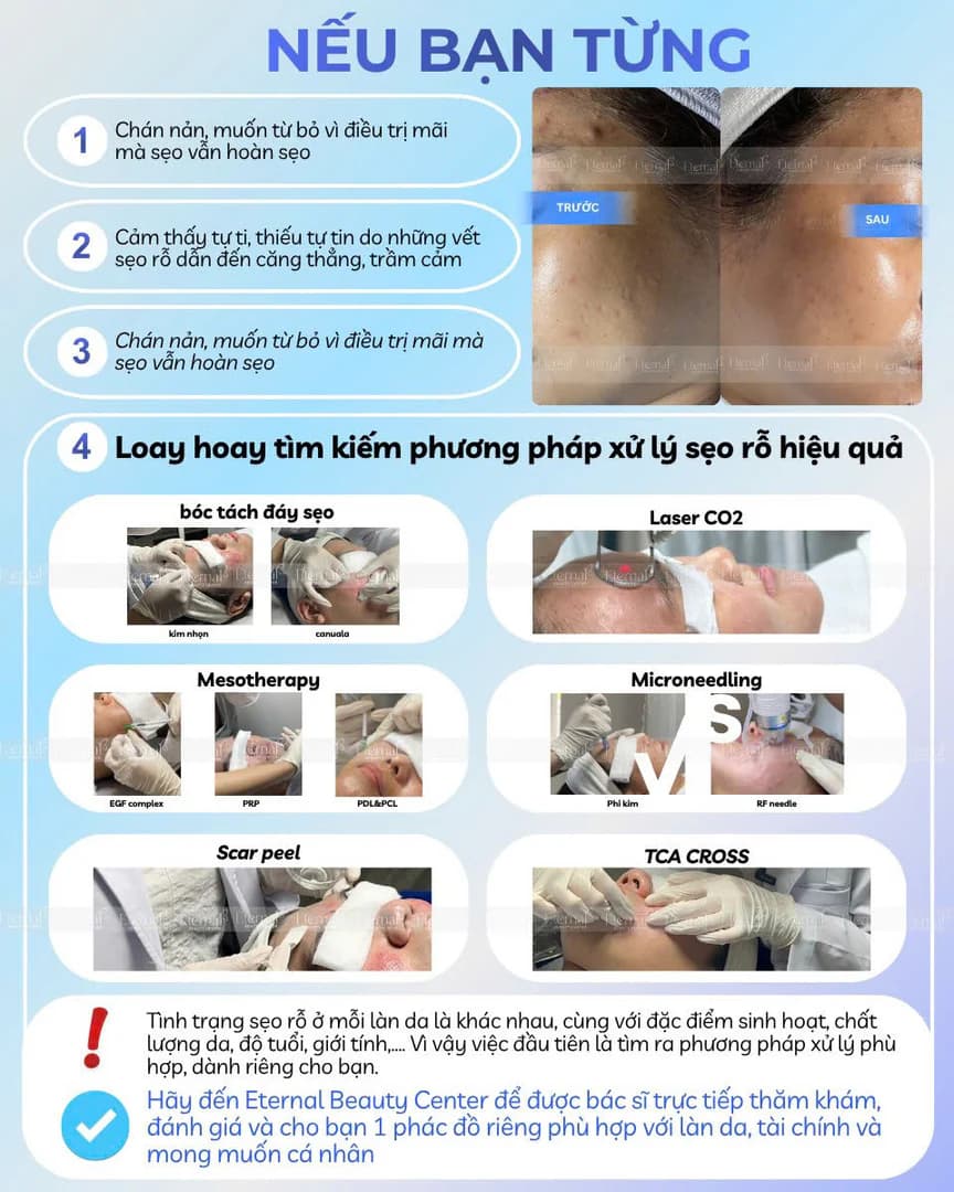 Đâu là thời điểm trị sẹo?