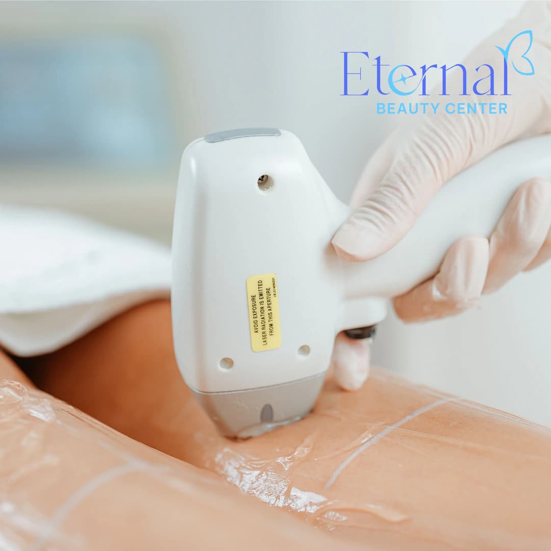 IPL vs Diode Laser Hair Removal: What's the Difference and Which Should You Choose?