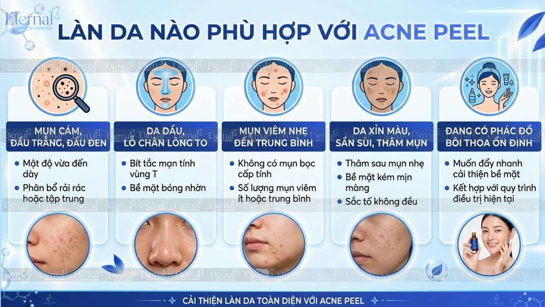 Làn da nào phù hợp với Acne Peel: mụn cám đầu trắng đầu đen, da dầu lỗ chân lông to, mụn viêm nhẹ đến trung bình, da xỉn màu thâm mụn