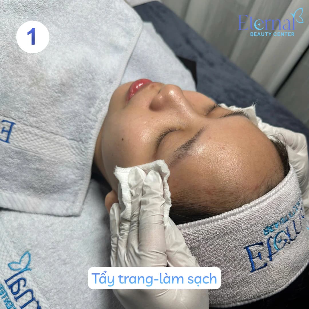 Bước 1 – Tẩy trang – làm sạch trong quy trình xử lý nhân mụn tại Eternal