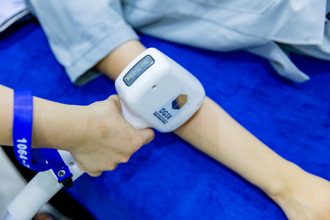 Triple-wavelength Diode Laser handpiece (755nm, 808nm, 1064nm) at Eternal Beauty Gò Vấp
