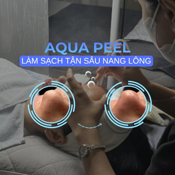 Aquapeel – 15-Step Deep Cleanse & Hydration