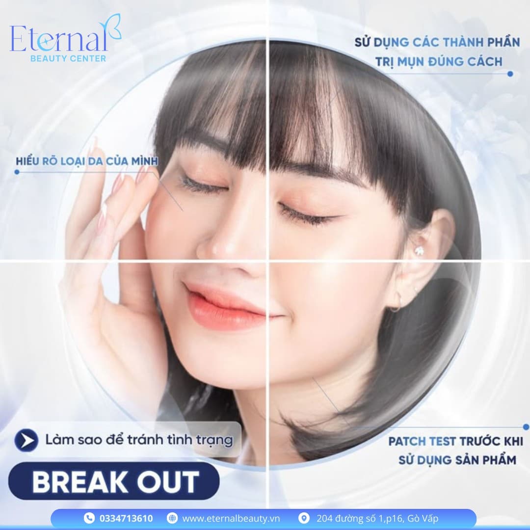 How to Avoid Breakouts When Starting a New Skincare Product