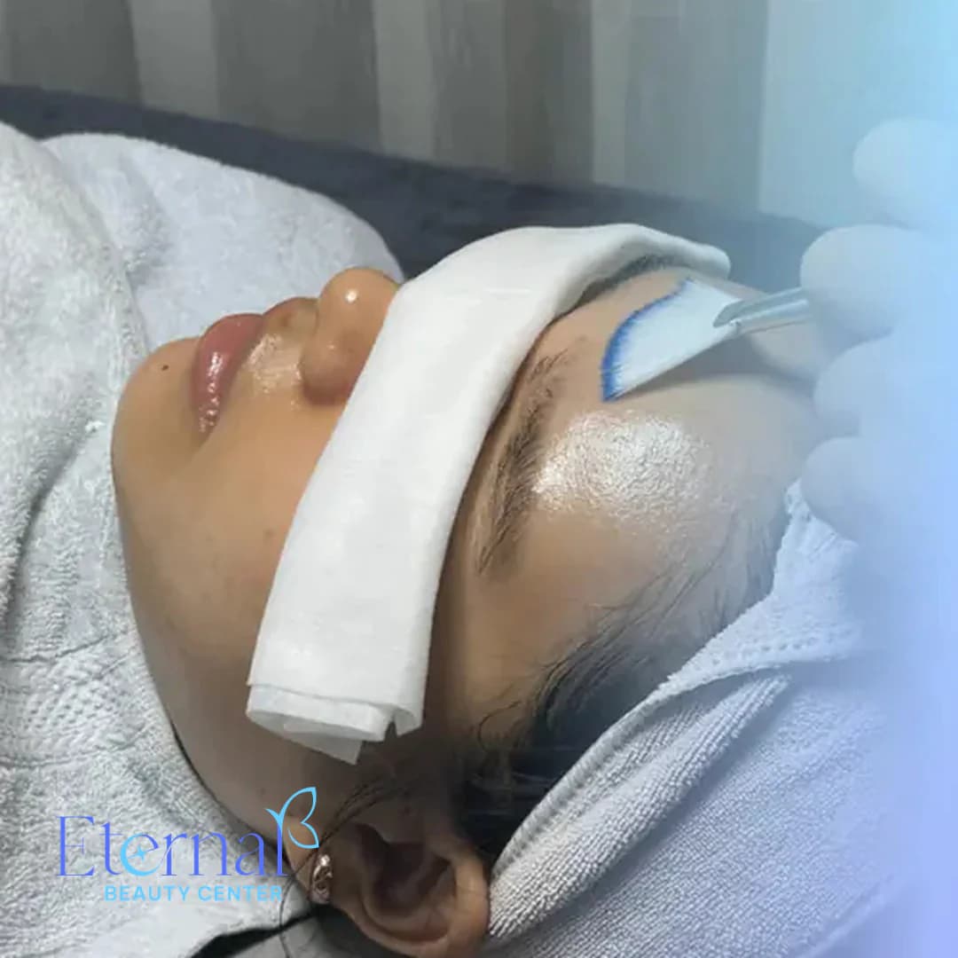 What Is a Chemical Peel? How It Works, Types, Benefits and What to Know Before You Try One