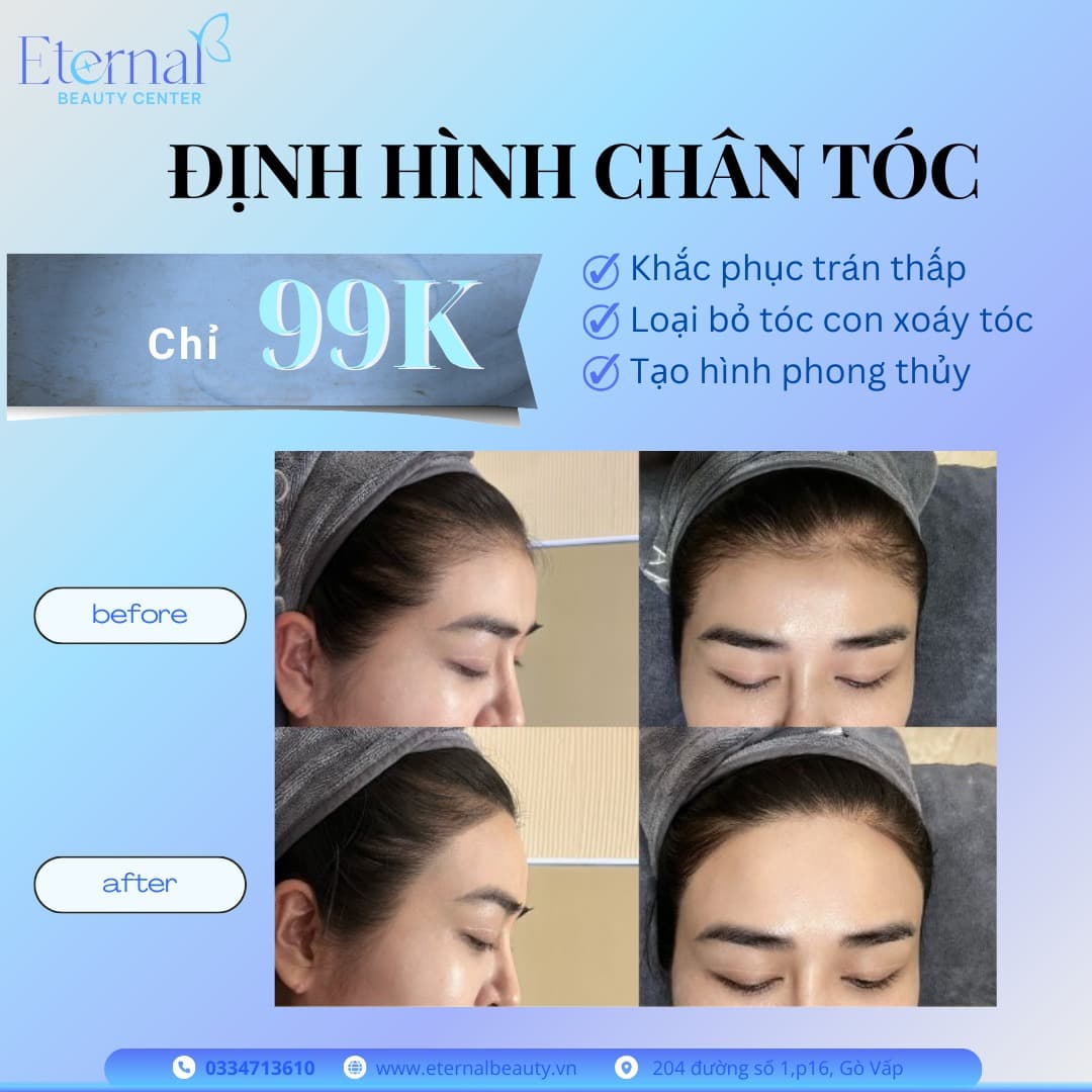 Định Hình Chân Tóc Chỉ 99K – Gương Mặt Thanh Thoát, Cân Đối Tự Nhiên