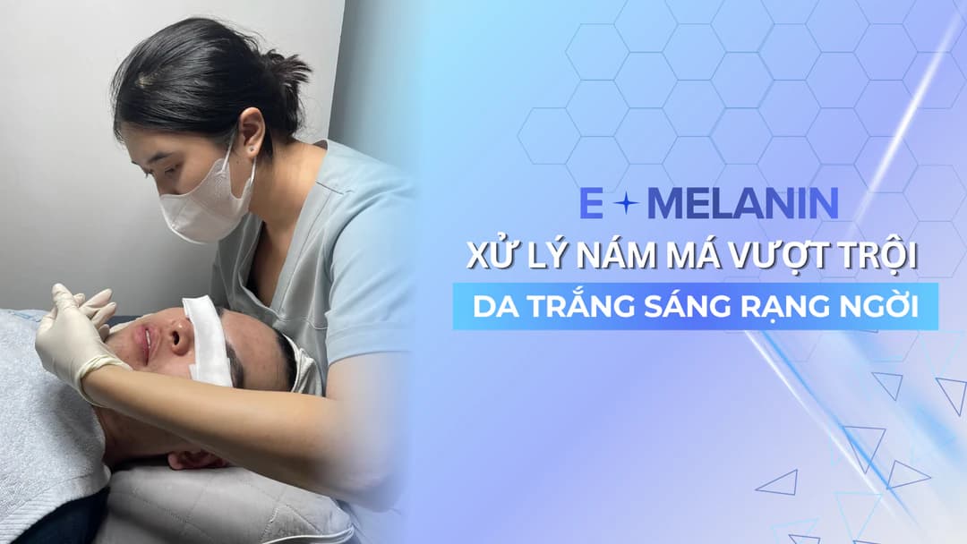 E-Mela – Trị Nám Má Kháng Trị Chuyên Sâu Tại Gò Vấp