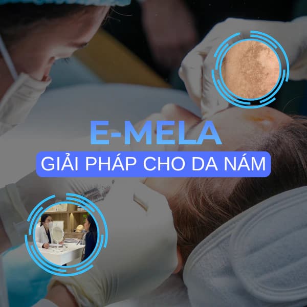 E-Mela – Resistant Melasma Treatment